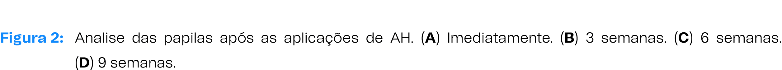 Figura 2: Analise das papilas ap s as aplica es de AH. (A) Imediatamente. (B) 3 semanas. (C) 6 semanas. (D) 9 semanas.