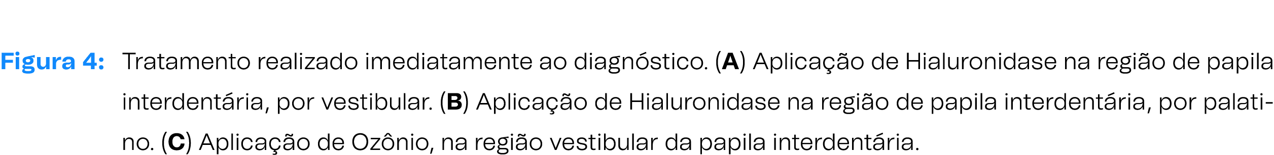 Figura 4: Tratamento realizado imediatamente ao diagn stico. (A) Aplica o de Hialuronidase na regi o de papila inter...